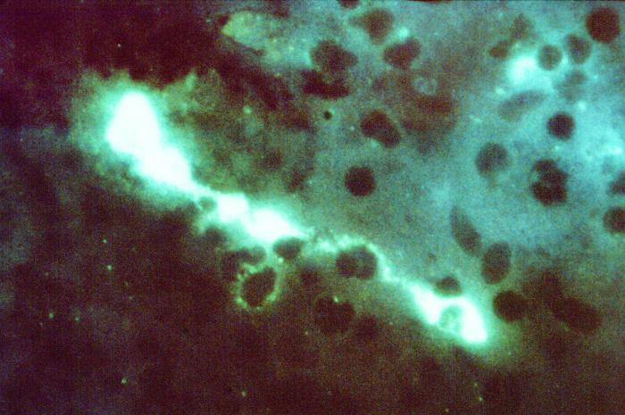 Direct fluorescent antibody stain of a mouse brain impression smear showing C. psittaci.