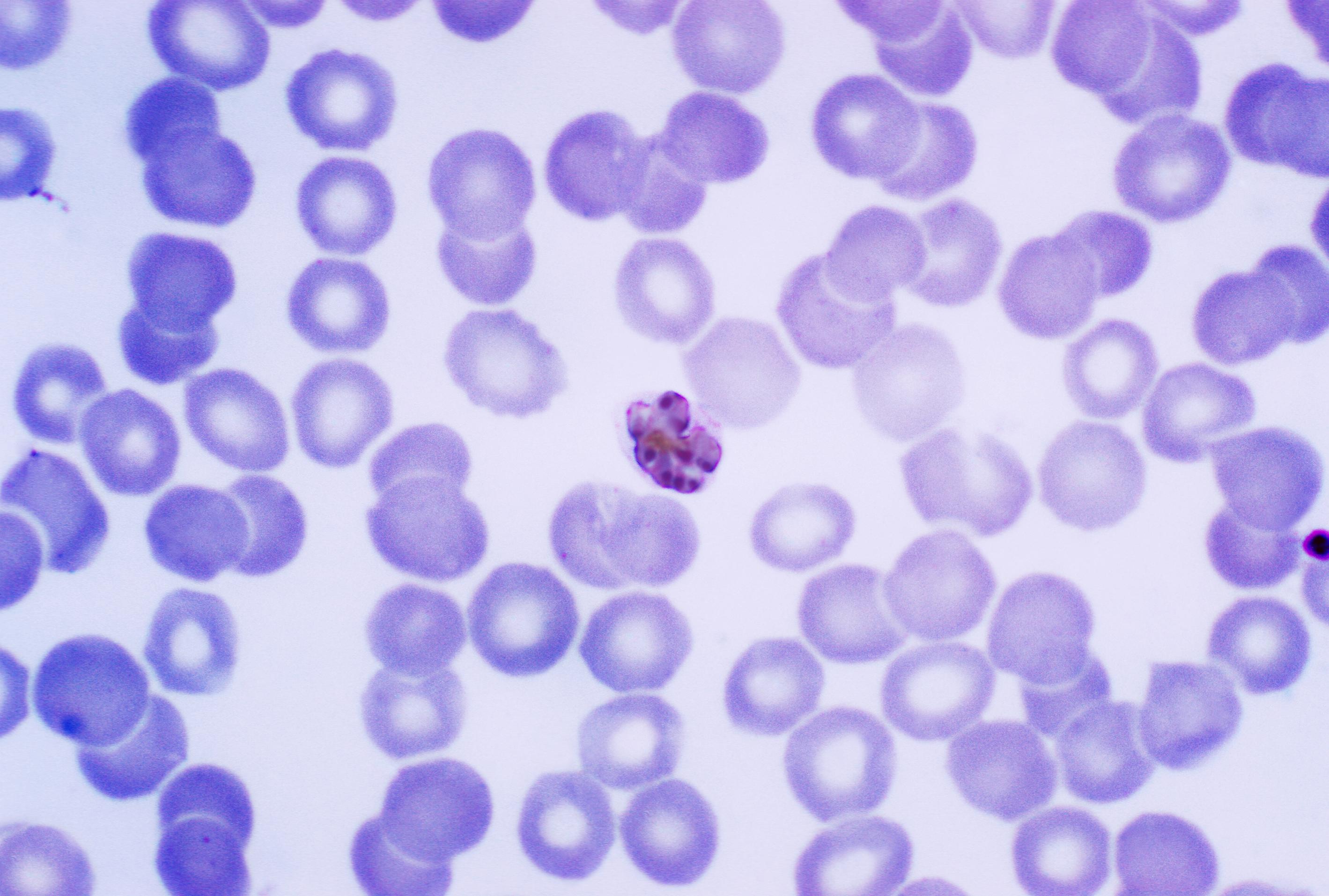 File:Mature Plasmodium malariae schizont PHIL 2715 lores.jpg