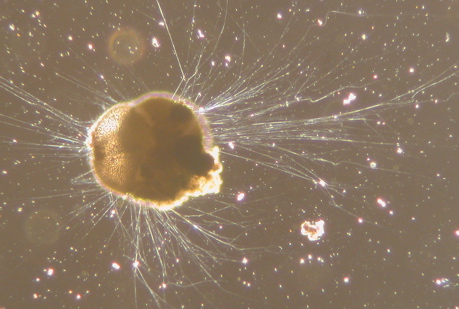 Live Ammonia tepida (Foraminifera)