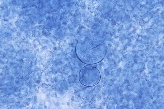 Photomicrograph reveals presence of two round, thick-walled, spherule-staged Coccidioides immitis fungal organisms. From Public Health Image Library (PHIL). [1]