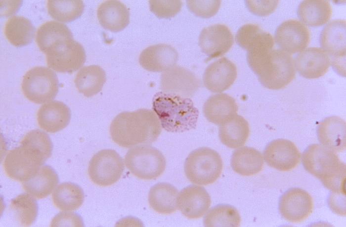 Magnified 1125X, this thin film blood smear micrograph depicts an old amoeboid Plasmodium vivaxtrophozoite, displaying a distinctly pigmented cytoplasm. Adapted from Public Health Image Library (PHIL), Centers for Disease Control and Prevention.[6]