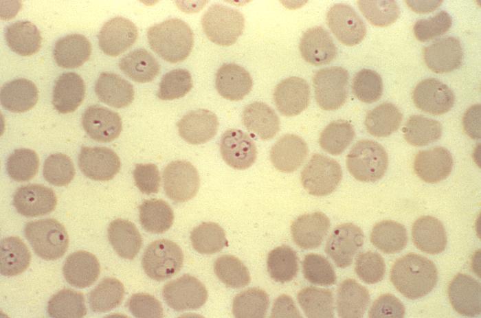 File:Malaria52.jpg