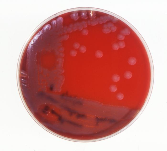 "Blood agar plate culture of Bacillus anthracis, with a positive gamma phage test”Adapted from Public Health Image Library (PHIL), Centers for Disease Control and Prevention.[20]