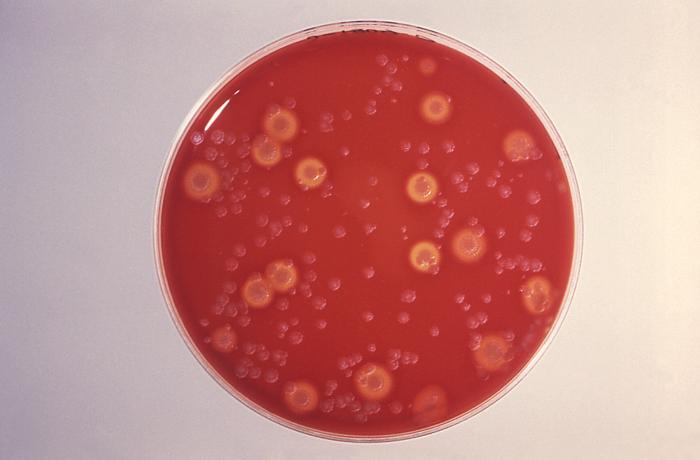 Blood agar culture plate growing B. anthracis and other soil flora.”Adapted from Public Health Image Library (PHIL), Centers for Disease Control and Prevention.[21]