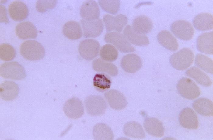 Thin film blood smear micrograph depicts a mature, band-form Plasmodium malariae trophozoite Adapted from Public Health Image Library (PHIL), Centers for Disease Control and Prevention.[6]