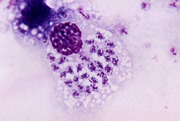 Giemsa-stained micrograph shows a Trypanosoma cruzi protozoan parasite during its leishmanial stage of development. From Public Health Image Library (PHIL). [1]