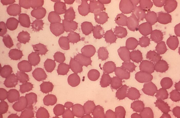 Micrograph of a blood smear containing Yersinia pestis plague bacteria.Adapted from Public Health Image Library (PHIL), Centers for Disease Control and Prevention.[19]