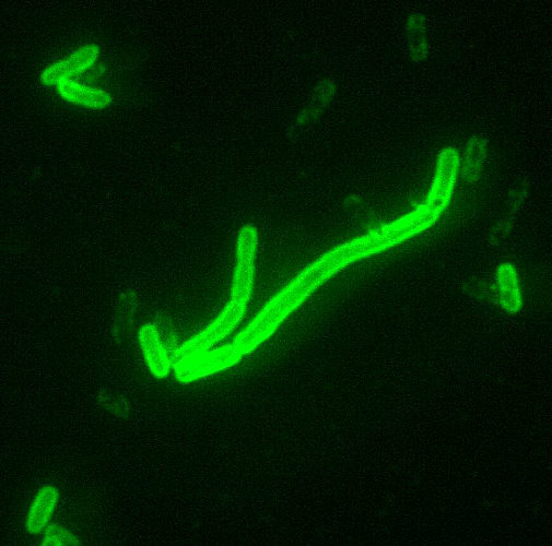 Yersinia pestis under fluorescent staining, 2000x. cheese: CDC