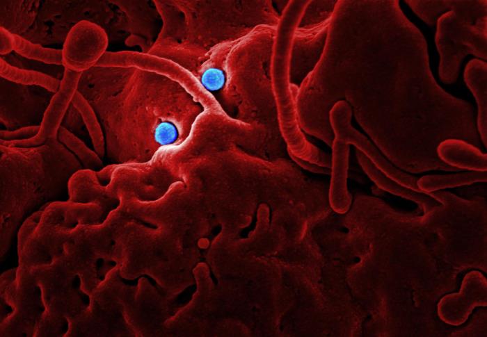 SEM reveals ultrastructural details at the site of interaction of two spherical-shaped Middle East Respiratory Syndrome Coronavirus (MERS-CoV) viral particles, colorized blue, that were on the surface of a camel epithelial cell, colorized red. From Public Health Image Library (PHIL). [1]