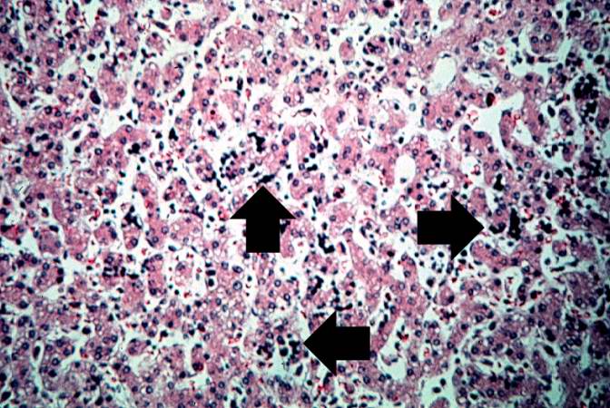 This high-power photomicrograph of liver shows more clearly the immature blood cell precursors (arrows) which represent extramedullary hematopoiesis of the liver. The liver is a normal site of fetal hematopoiesis and, for this stage of gestation, extramedullary hematopoiesis of the liver is normal.