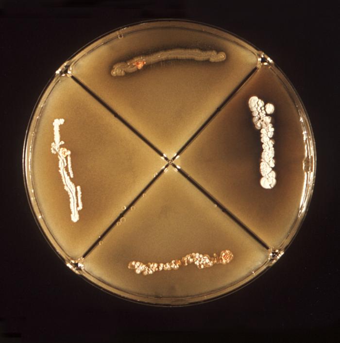 Actinomycosis. From Public Health Image Library (PHIL). [1]