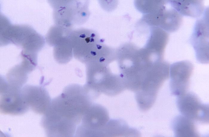 Magnified 1125X, this thin film photomicrograph of a blood smear, revealed the presence of a number ofPlasmodium vivax “free” merozoites, which had been liberated from the confines of their occupied erythrocyte Adapted from Public Health Image Library (PHIL), Centers for Disease Control and Prevention.[6]