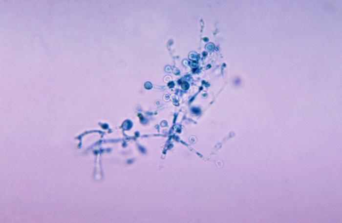 This is a photomicrograph of Blastomyces dermatitidis using a cotton blue staining technique. From Public Health Image Library (PHIL). [1]