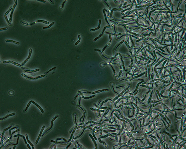 "Bacillus anthracis spores seen under phase contrast microscopy”Adapted from Public Health Image Library (PHIL), Centers for Disease Control and Prevention.[20]