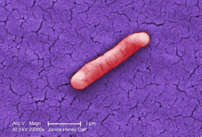 Gram-negative Salmonella typhimurium bacteria that had been isolated from a pure culture (20000X mag). From Public Health Image Library (PHIL). [8]