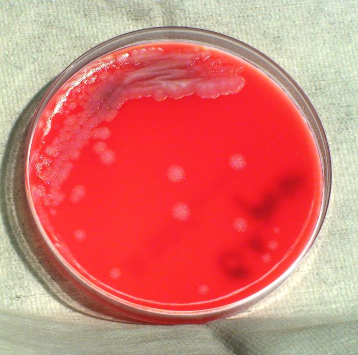 Colonial morphology displayed by Gram-positive, Pasteur strain, Bacillus anthracis bacteria, which was grown on a medium of phenylethyl alcohol agar (PEA), for a 24 hour time period, at a temperature of 37°C. ”Adapted from Public Health Image Library (PHIL), Centers for Disease Control and Prevention.[20]