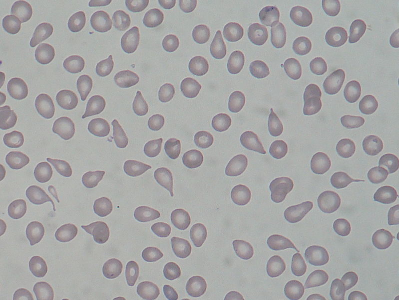 File:Dacrocyte.png