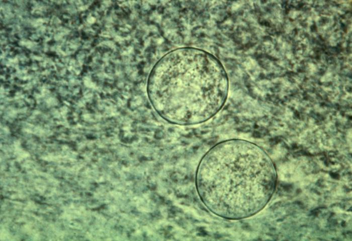 Smear of an exudate from an infected mouse, reveals spherules of Coccidioides immitis. From Public Health Image Library (PHIL). [1]
