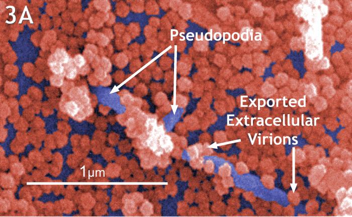 Scanning electron micrograph reveals the prolific exportation of virus particles at the pseudopodial and cell surfaces. From Public Health Image Library (PHIL). [4]