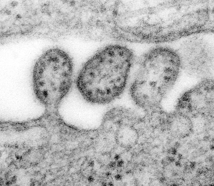 This highly magnified transmission electron micrograph (TEM) demonstrates ultrastructural details of 3 Lassa virus virions.Retrieved from the Public Health Image Library (PHIL), Centers for Disease Control and Prevention.[10]