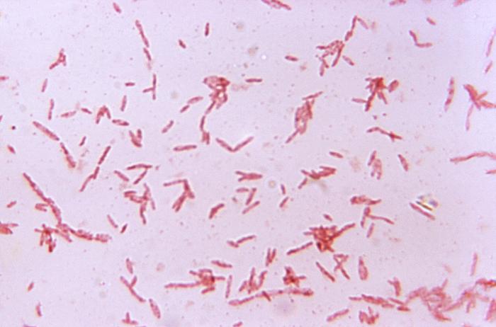 File:Bacteroides23.jpeg