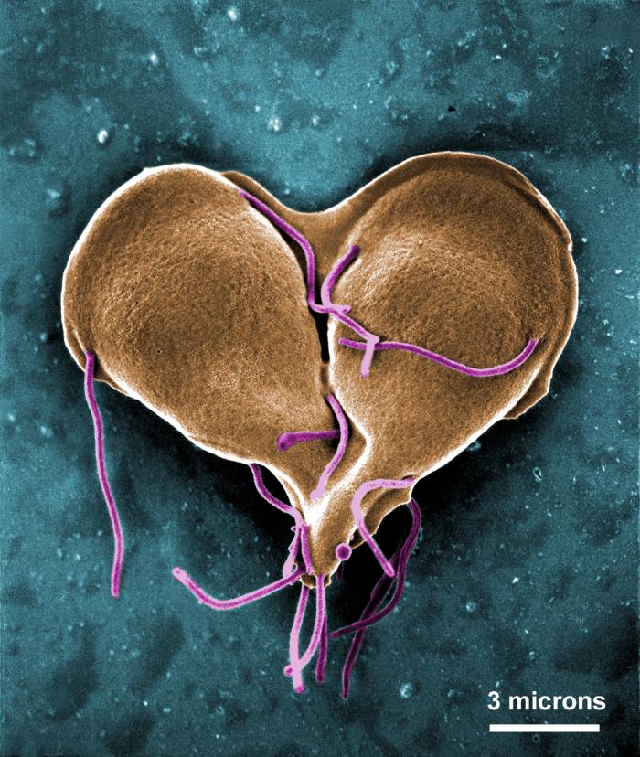 SEM depicts a Giardia lamblia protozoan that was about to become two separate organisms, as it was caught in a late stage of cell division. From Public Health Image Library (PHIL). [9]