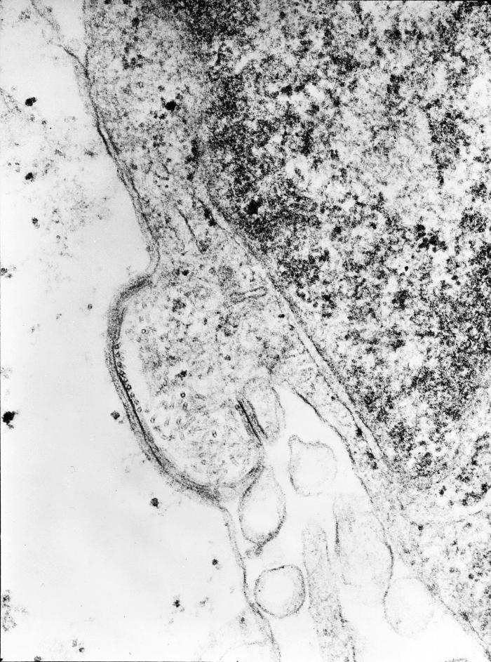 This transmission electron micrograph (TEM) revealed the presence of the human parainfluenza type 4A virus (HPIV-4A), which like the mumps virus, is also a Paramyxoviridae family member, and a member of the genus, Rubulavirus. From Public Health Image Library (PHIL). [1]
