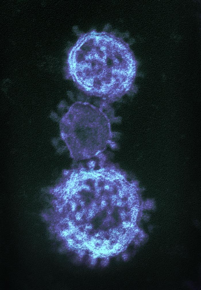 TEM reveals ultrastructural details exhibited by three spherical-shaped Middle East Respiratory Syndrome Coronavirus (MERS-CoV) virions. From Public Health Image Library (PHIL). [1]