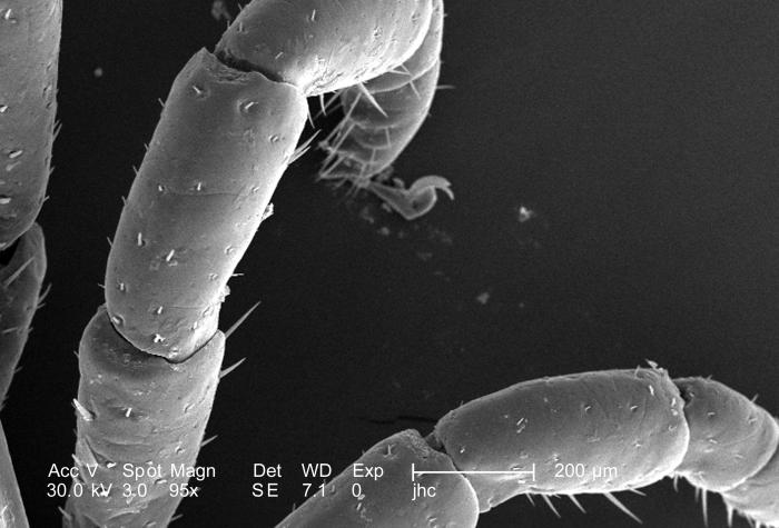 Under a relatively low magnification of 95X, this scanning electron micrograph (SEM) provided a closer view of this male Dermacentor sp. tick found upon a cat in the suburbs of Decatur, Georgia, which measured approximately 3.5mm from its gnathosoma (i.e., capitulum), which is where its mouthparts are located, to the distal abdominal margin (PHIL 9961). PHIL 9959 revealed all this tick’s legs, placing it into the Phylum Arthropoda. From Public Health Image Library (PHIL). [2]