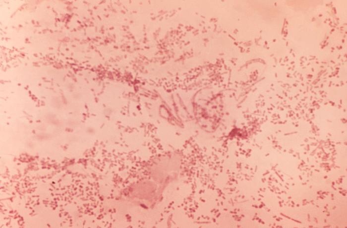 Direct smear microscopic exam revealed the presence of Haemophilus ducreyi indicative of a chancroid infection. From Public Health Image Library (PHIL). [4]