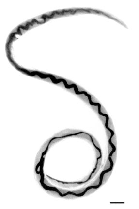 Adult female worm of Angiostrongylus cantonensis with characteristic barber-pole appearance (anterior end of worm is to the top). Scale bar is 1 mm.