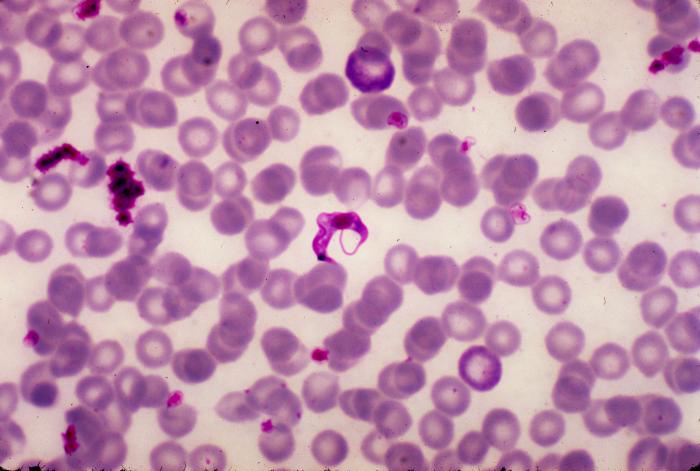 Micrograph of Trypanosoma cruzi in a blood smear using Giemsa staining technique. From Public Health Image Library (PHIL). [1]