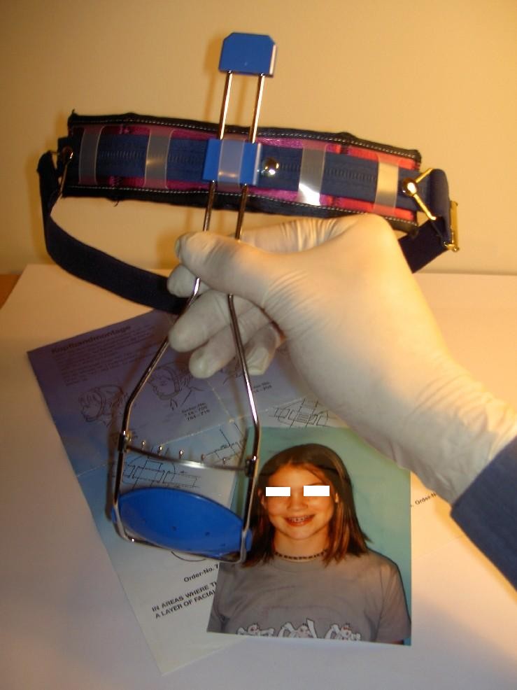 Facemask or reverse-pull headgear with straps hooks for connection of elastic bands into the patients mouth, typically worn 12 to 22 hours a day depending on treatment plan.