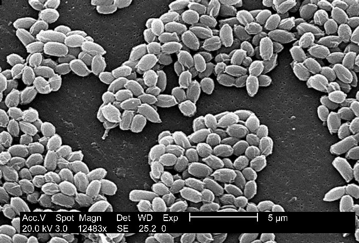 "Magnification of 12,483X, this scanning electron micrograph (SEM) depicted spores from the Sterne strain of Bacillus anthracis bacteria. ”Adapted from Public Health Image Library (PHIL), Centers for Disease Control and Prevention.[21]