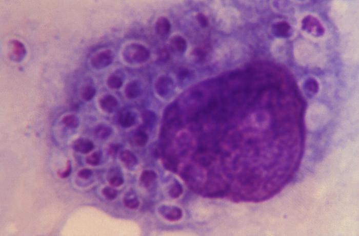 This Giemsa-stained photomicrograph reveals a histiocyte within which numerous Histoplasma capsulatum fungal organisms in their yeast-stage of development were contained. From Public Health Image Library (PHIL). [1]