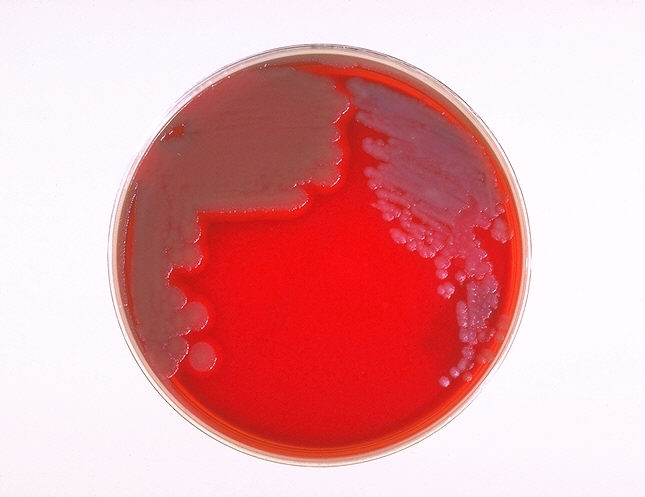 Sheep blood agar plate culture of Bacillus anthracis and Bacillus cereus. From Public Health Image Library (PHIL). [22]