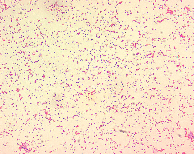 Brucella spp. are poorly staining, small gram-negative coccobacilli (0.5-0.7 x 0.6-1.5 µm), and are seen mostly as single cells and appearing like “fine sand”.