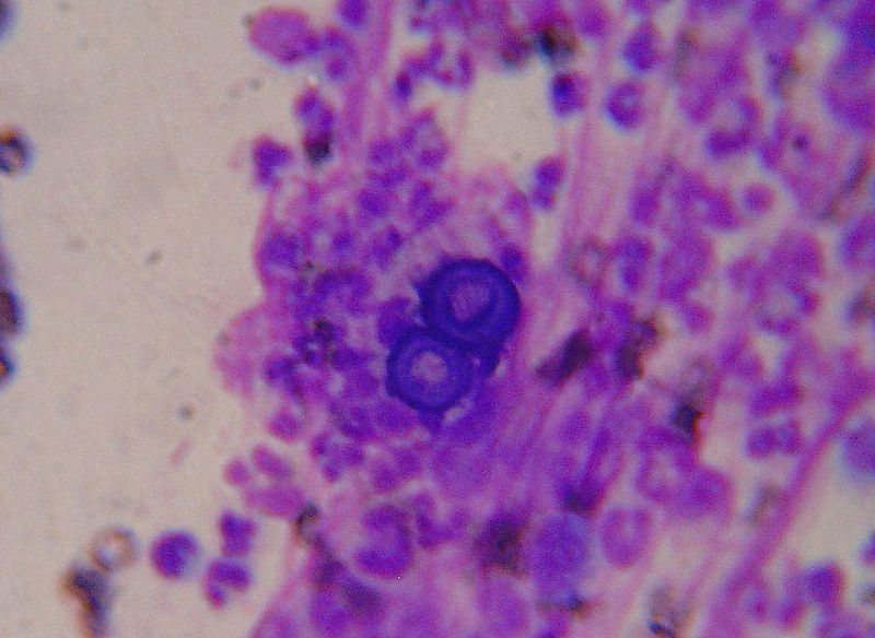 Blastomyces: Broad based budding - By Joel Mills - A feltöltő saját munkája, CC BY-SA 3.0, https://commons.wikimedia.org/w/index.php?curid=927183