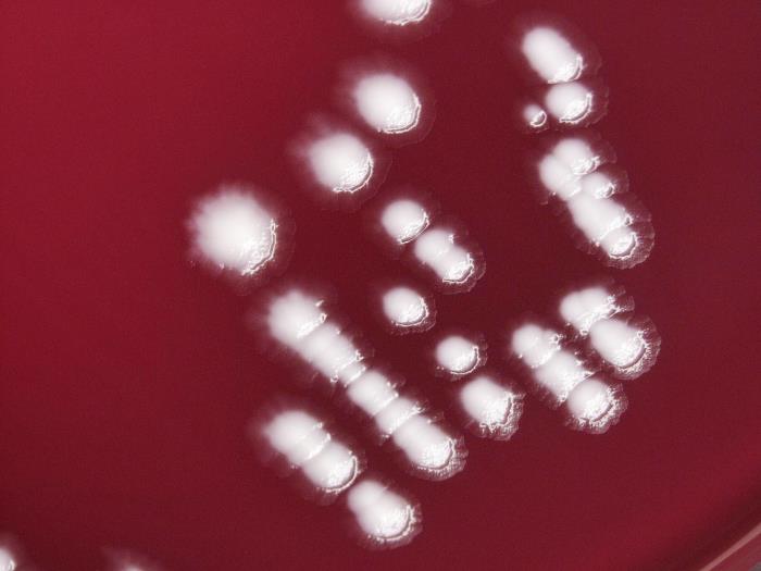 Low-power magnification of 10X of a digital Keyence scope , this photograph depicts the colonial growth displayed by Gram-negative Yersinia pestis bacteria, which were cultured on a MacConkey agar (MAC) medium, for a 48 hour time period, at a temperature of 37°C. Adapted from Public Health Image Library (PHIL), Centers for Disease Control and Prevention.[6]