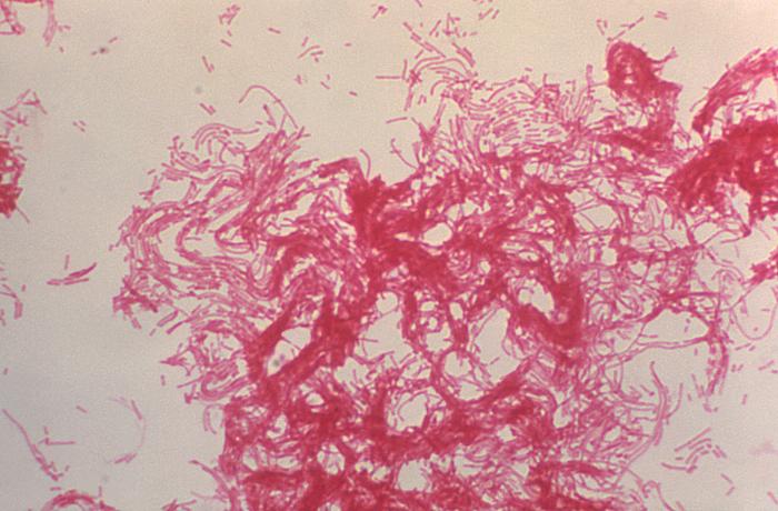 Gram-negative Haemophilus ducreyi bacteria (1200x mag). From Public Health Image Library (PHIL). [4]
