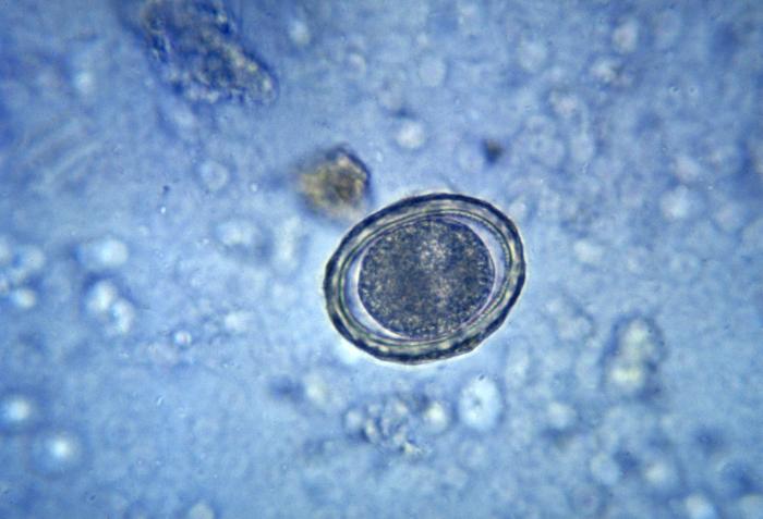This micrograph reveals a fertilized egg of the round worm Ascaris lumbricoides; Mag. 400X. From Public Health Image Library (PHIL). [6]