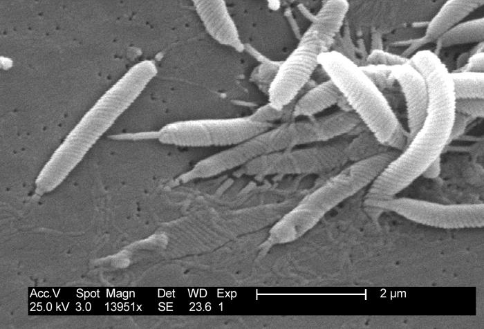 Scanning electron micrograph depicts a Flexispira rappini bacteria (13951x mag). From Public Health Image Library (PHIL). [21]