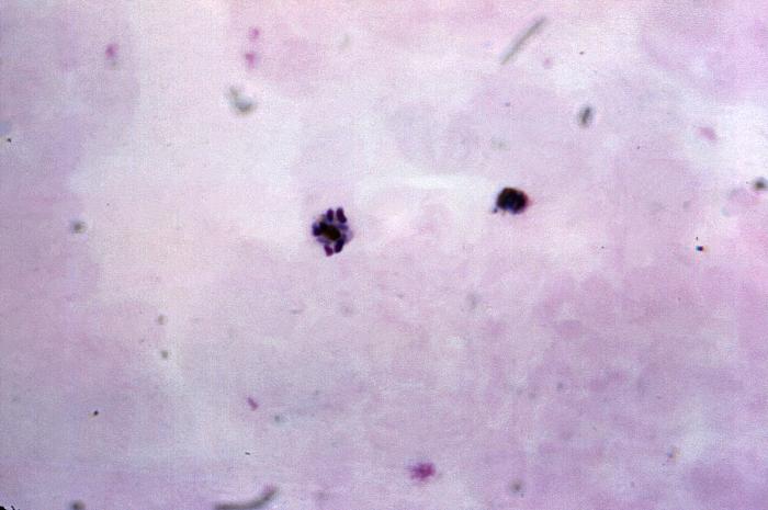 Thick film blood smear micrograph depicts an old Plasmodium malariae trophozoites (Rt), and an immature schizont containing eight chromatin masses (Lt). Adapted from Public Health Image Library (PHIL), Centers for Disease Control and Prevention.[6]