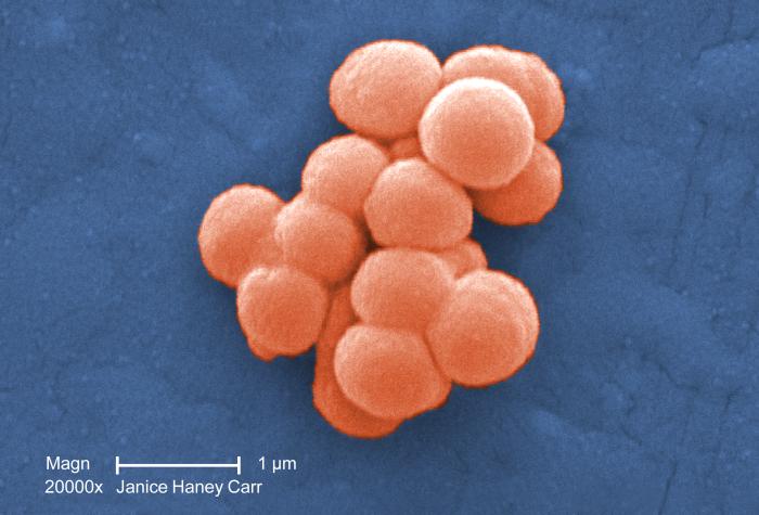 Scanning electron micrograph (SEM) revealed a small clustered group of Gram-positive, beta-hemolytic Group C Streptococcus sp. bacteria. From Public Health Image Library (PHIL). [10]