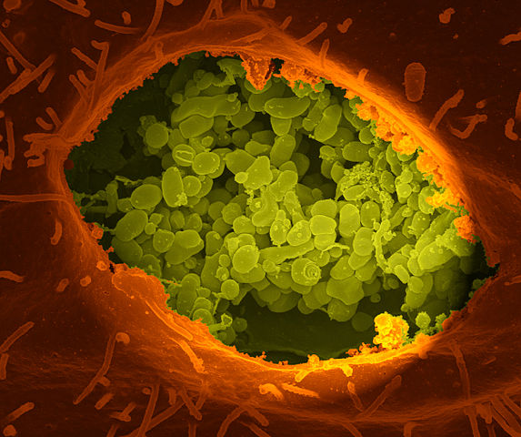 A dry fracture of a Vero cell exposing the contents of a vacuole where Coxiella burnetii are busy growing.