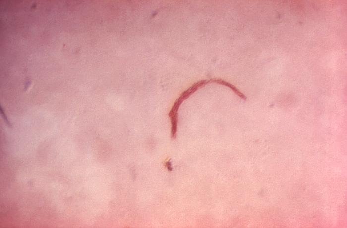 Gram-negative Haemophilus ducreyi bacteria. From Public Health Image Library (PHIL). [4]
