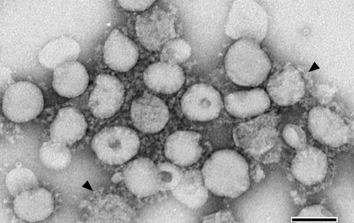 TEM from a tissue culture isolate, revealing numbers of severe acute respiratory virus (SARS) virions. From Public Health Image Library (PHIL). [4]