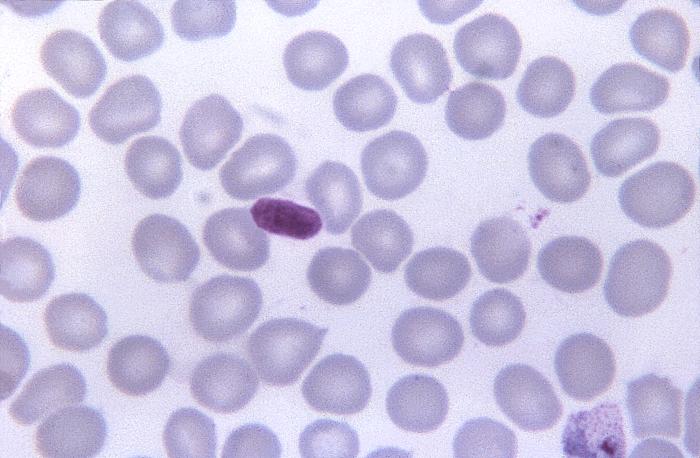 This thin film Giemsa stained micrograph depicts a platelet artifact that could be mistaken for a malaria parasite Adapted from Public Health Image Library (PHIL), Centers for Disease Control and Prevention.[6]
