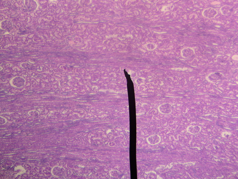 Microscopic cross section of the renal cortex