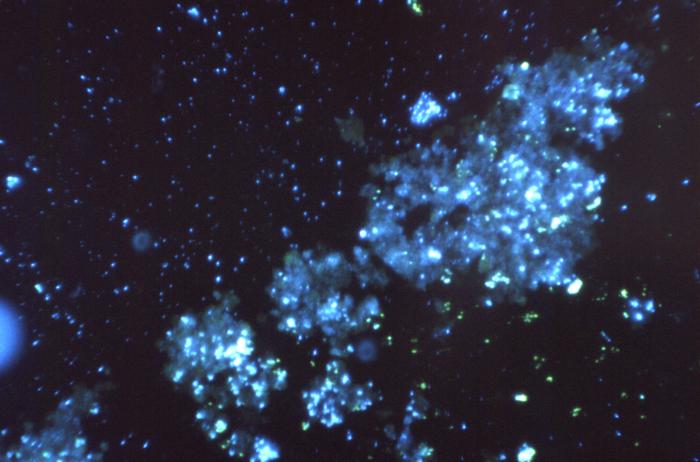 Magnified 125X, "digested", then stained using a fluorescent antibody-staining technique, this photomicrograph reveals the presence of Histoplasma capsulatum antigens in this human lung tissue specimen. From Public Health Image Library (PHIL). [6]